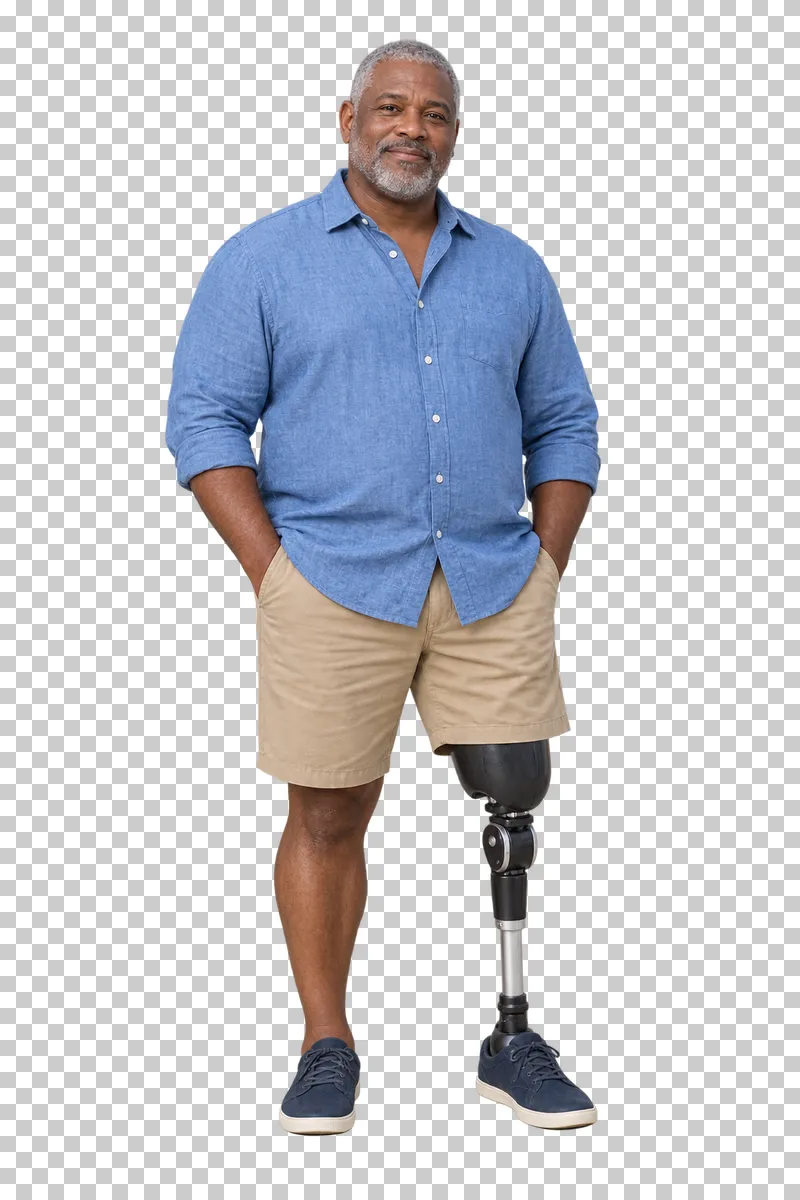 A man in everyday clothing standing with an above-knee prosthesis.