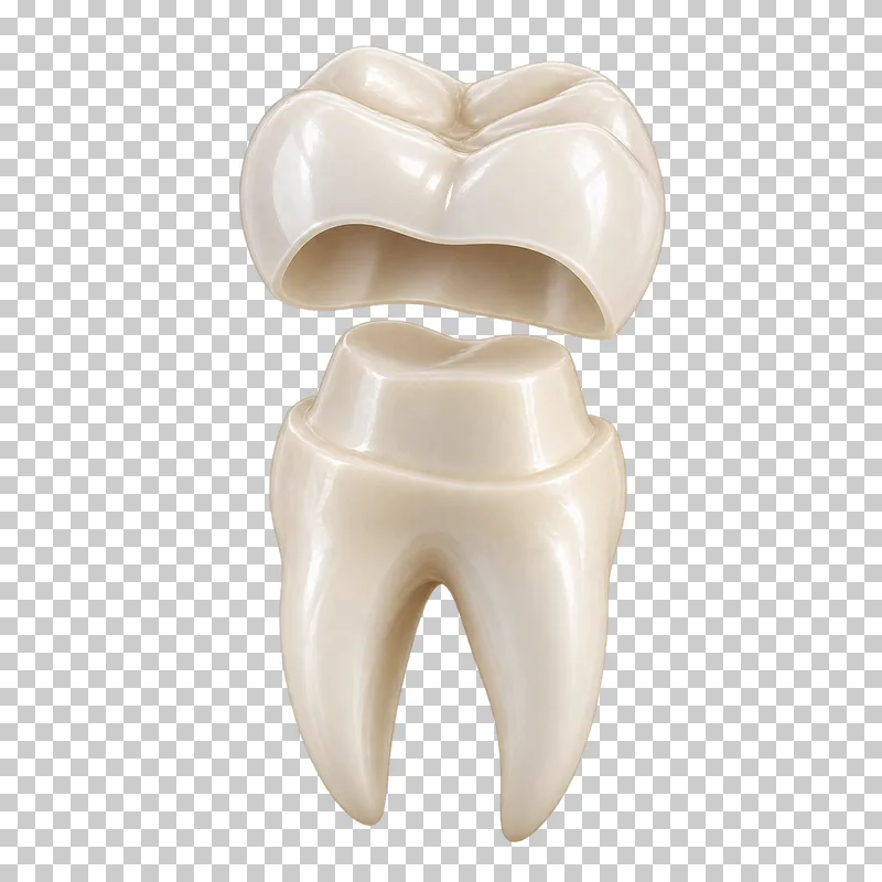 Prepared ivory tooth with a detached hollow crown above it.
