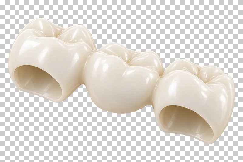Three connected ivory teeth forming a dental bridge.